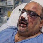 Shezad Akbar attacked in Cambridge, UK, gets broken nose and jaw